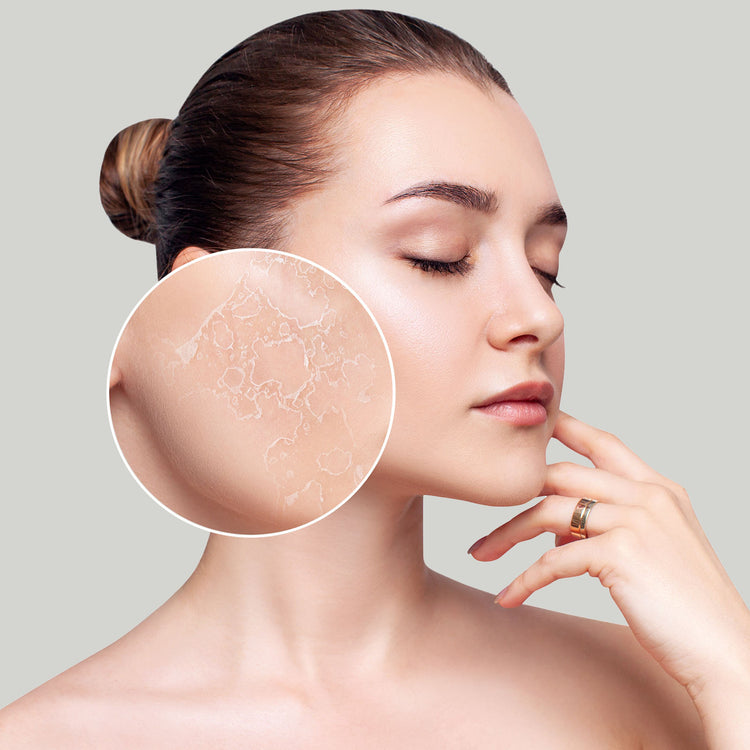 Skin Type - Dry Skin