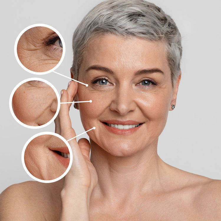 Skin Concerns - Fine Lines and Wrinkles