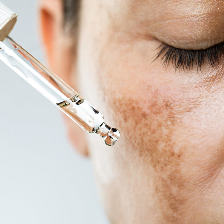 Skin Concerns - Hyperpigmentation