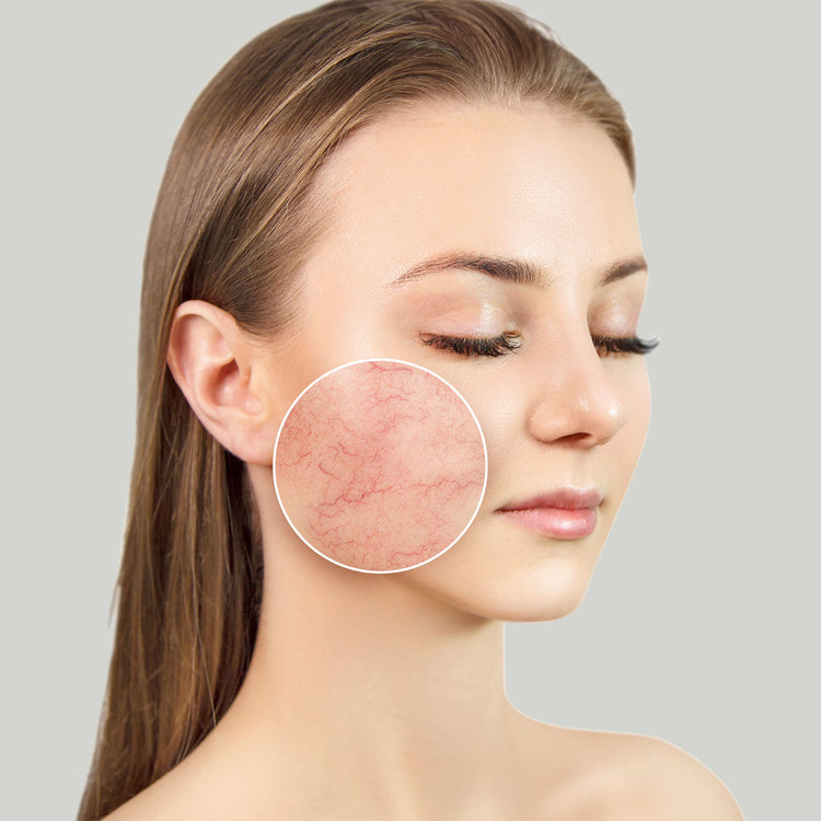 Skin Concerns - Sensitive Skin
