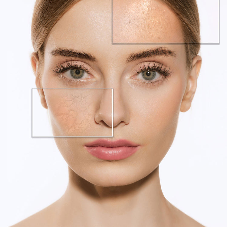 Skin Type - Combination Skin