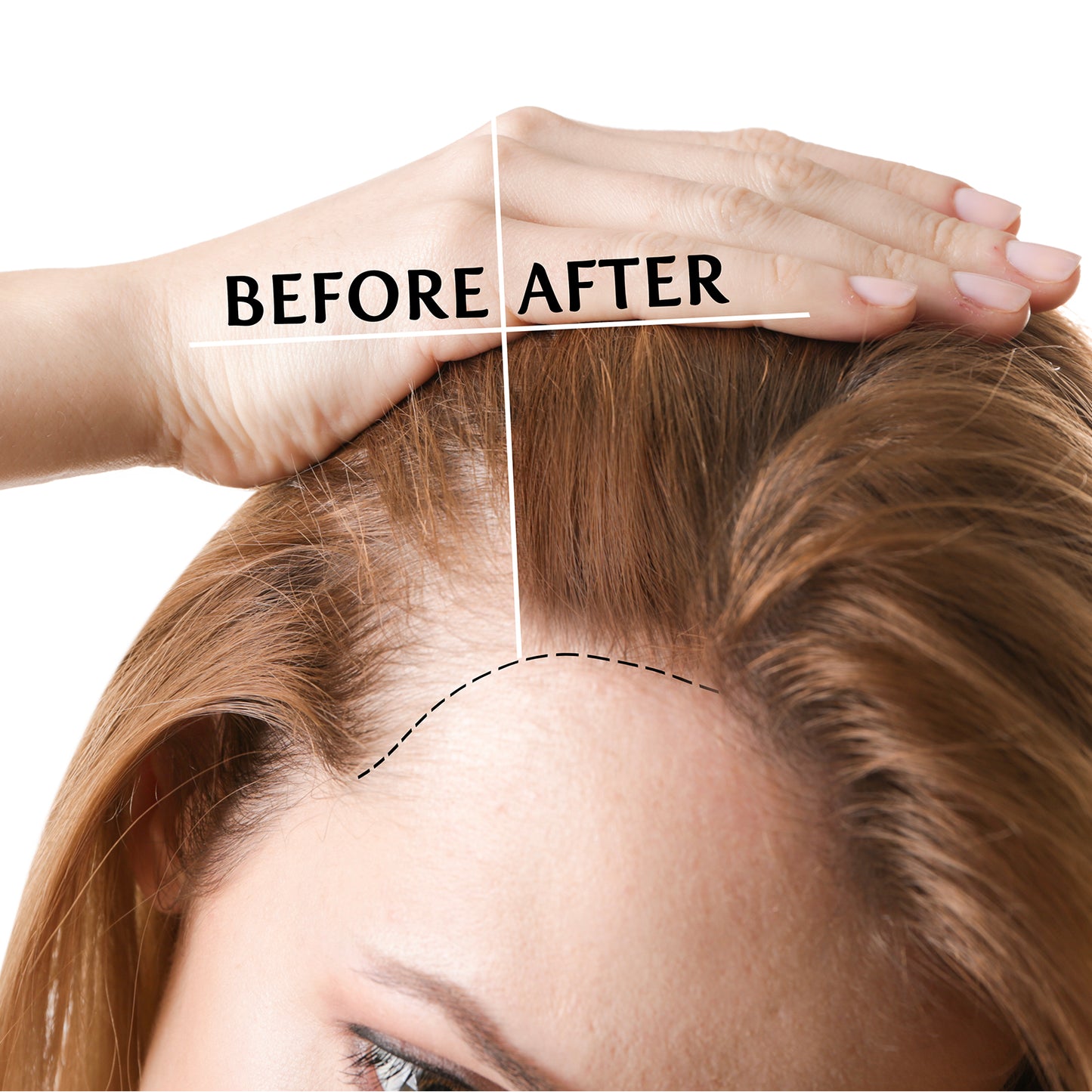 REVIVOGEN MD BIO-CLEANSING SHAMPOO + CONDITIONER + TREATMENT KIT