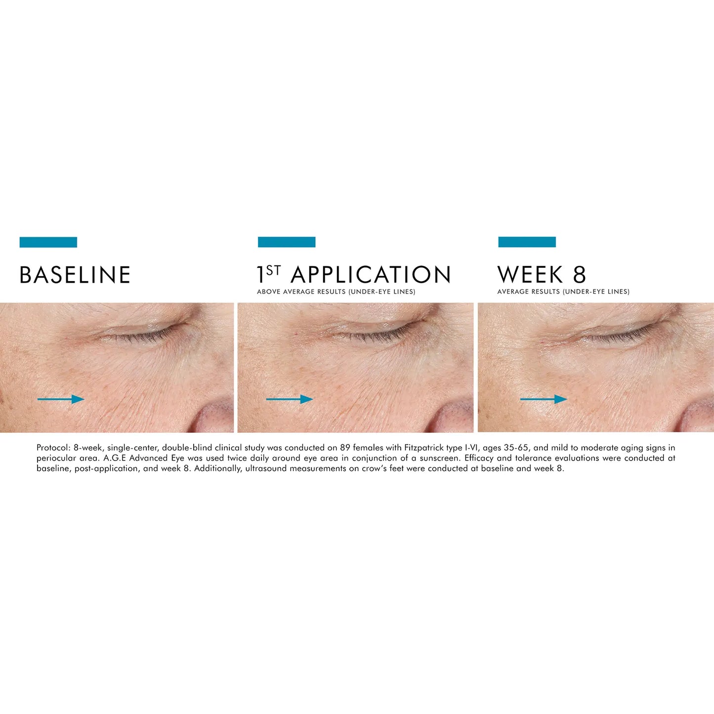 SkinCeuticals A.G.E. Advanced Eye 15ml / 0.5 fl oz
