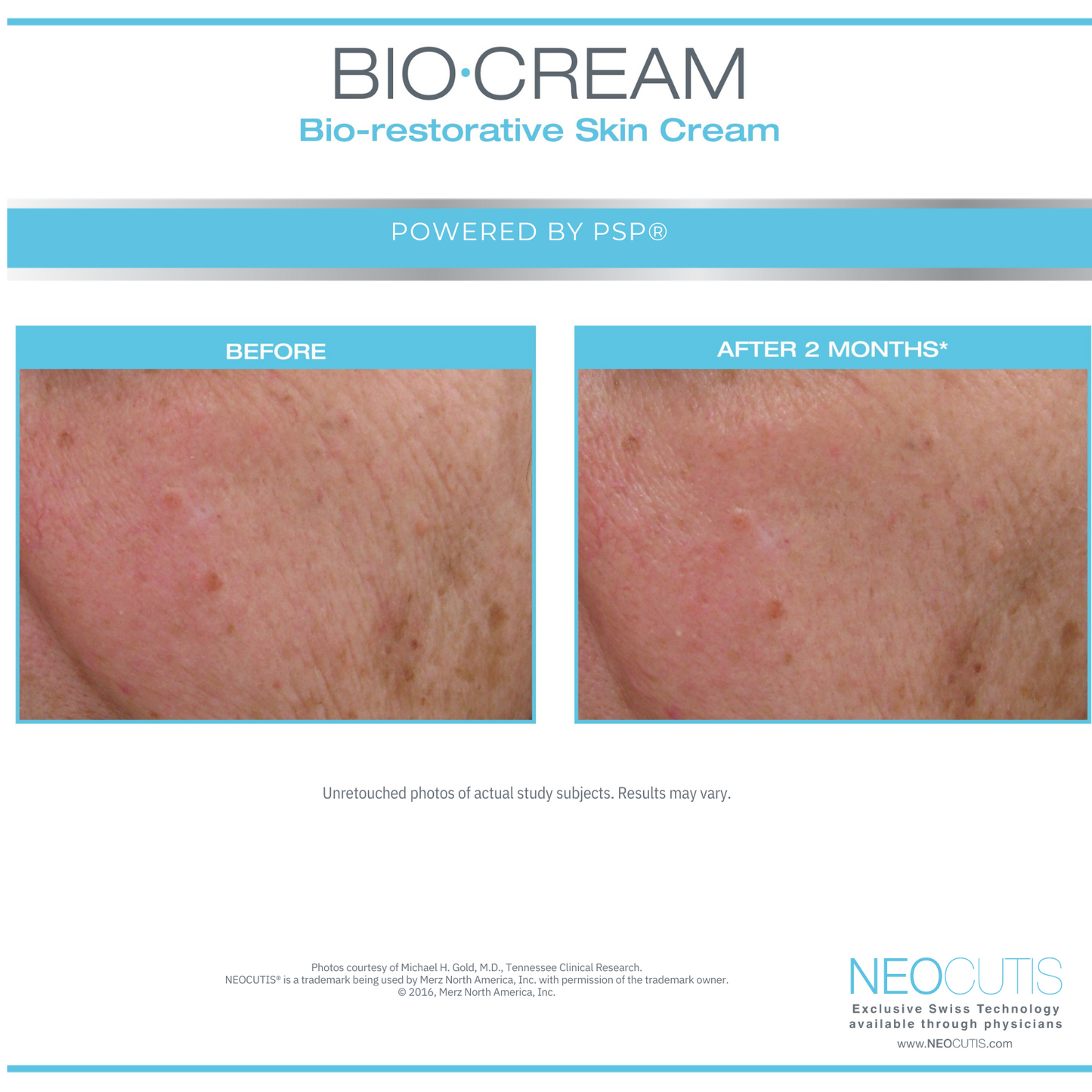 NeoCutis Bio Cream Firm Smoothing and Tightening Cream 50 ml / 1.7 fl oz