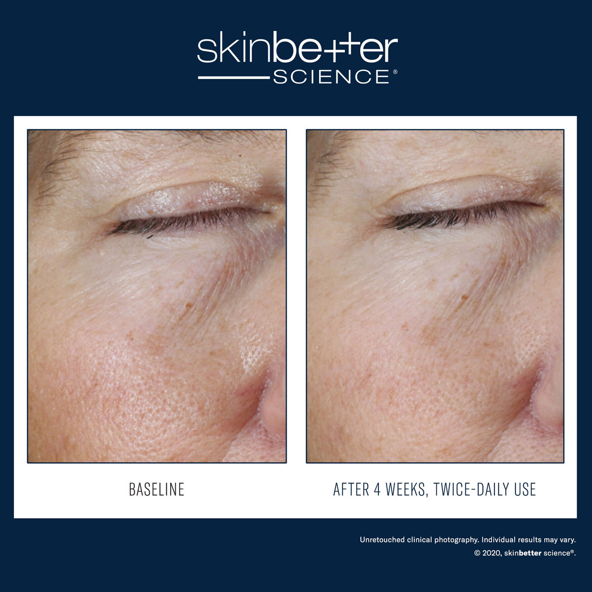 Skinbetter Science: Instant Effect Gel EYE 15ml