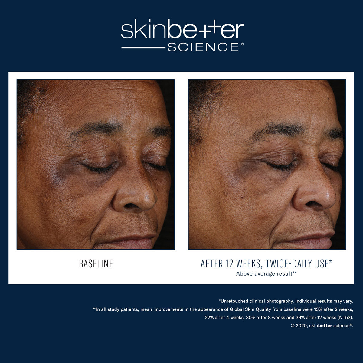 Skinbetter Science: Mystro Active Balance Serum 30ml