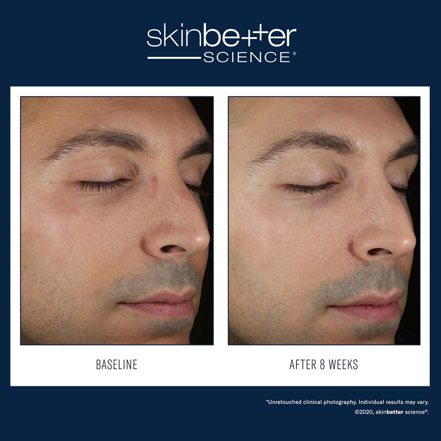Skinbetter Science: Solo Hydrating Defense MEN 50ml