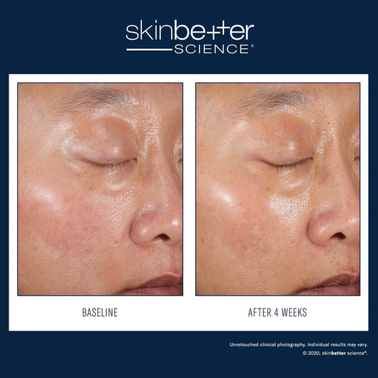 Skinbetter Science: Duo Kit 30ml