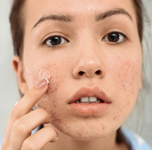 The Pitfalls of Viral Skincare Products: My Personal Experience