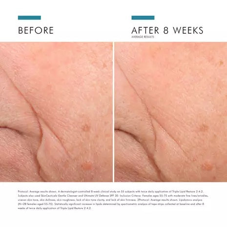 SkinCeuticals : Triple Lipid Restore 2:4:2 15 ml | Cadeau à l'achat