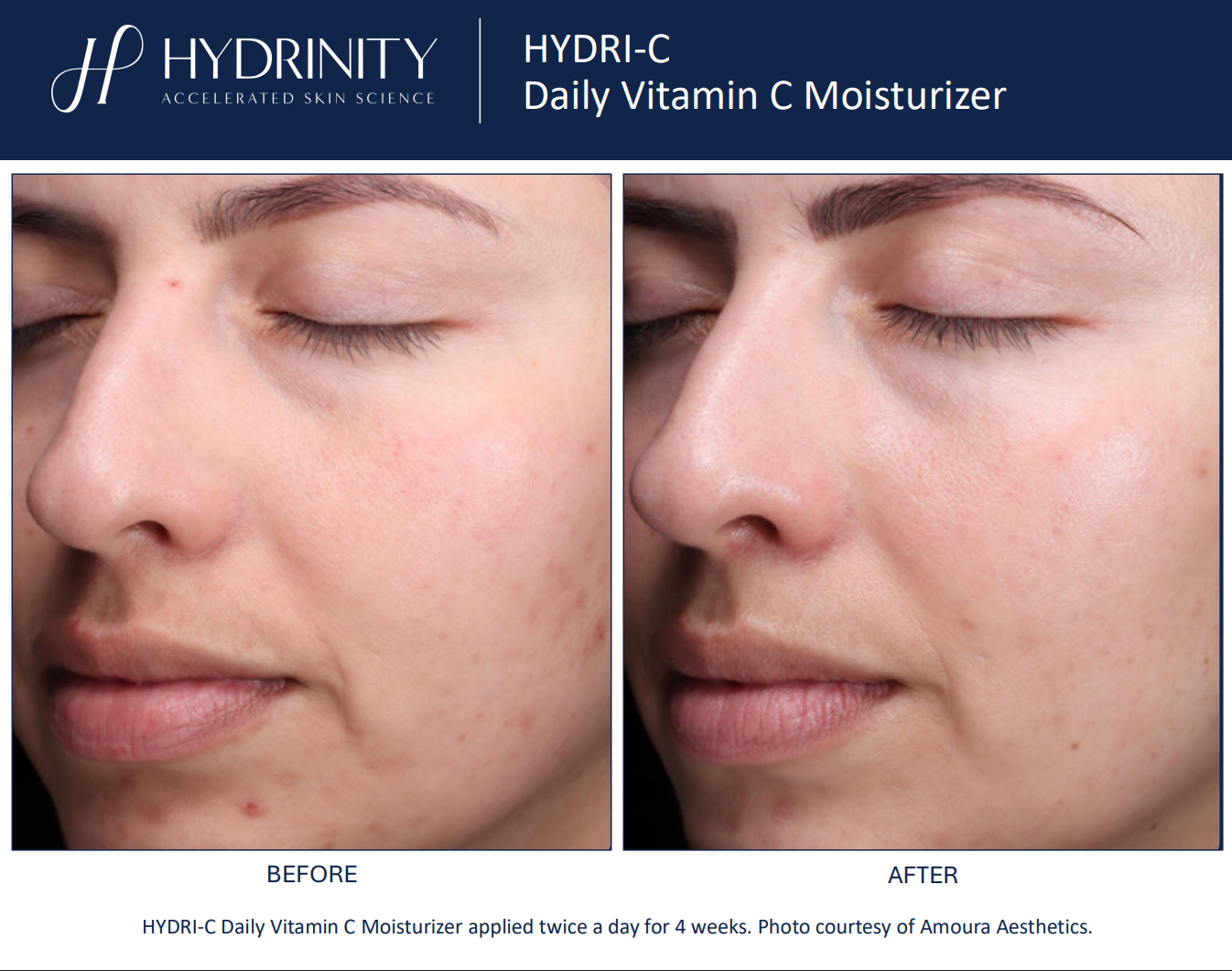 Hydrinity: Hydri-C Daily Vitamin C Moisturizer | 50ml