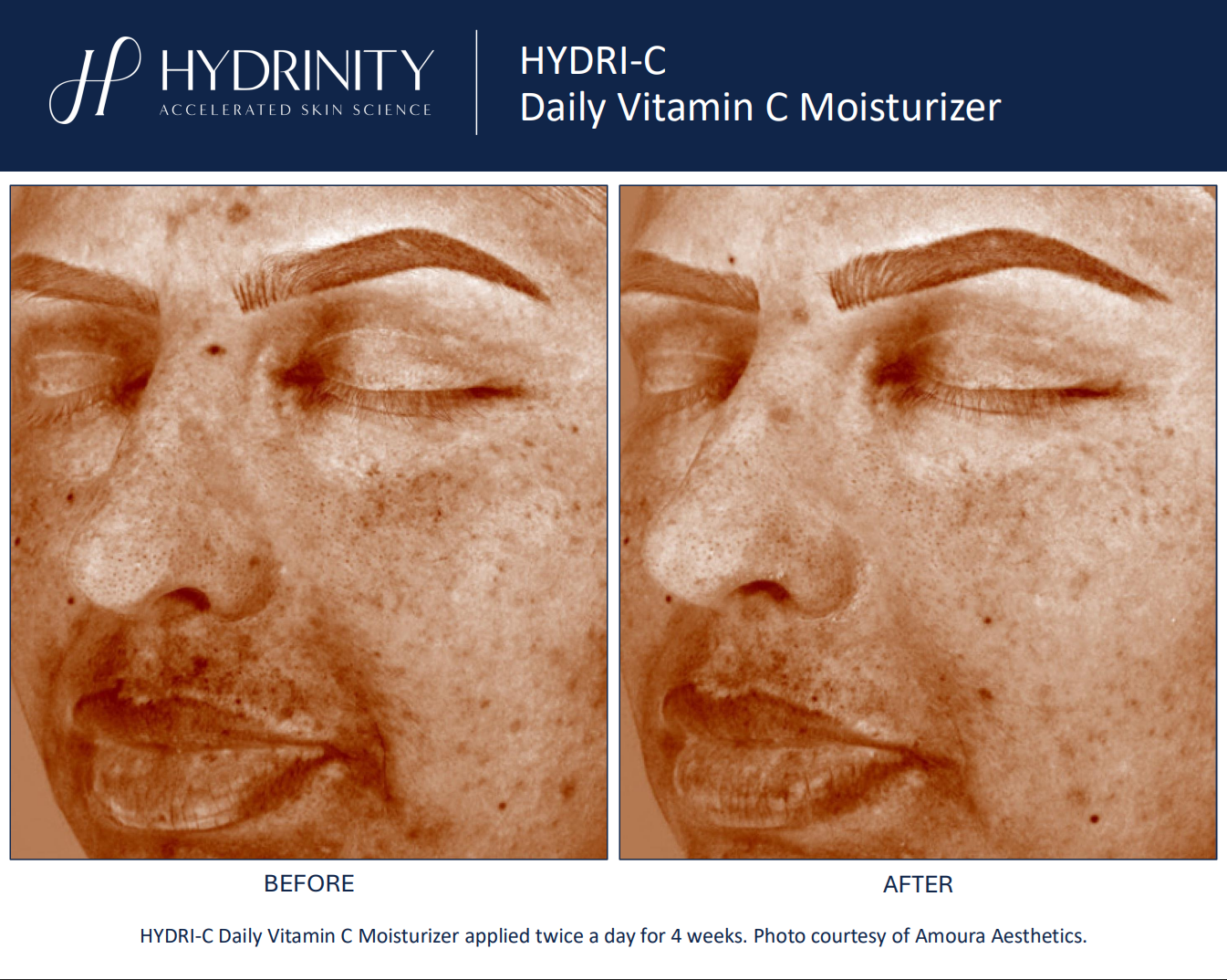 Hydrinity: Hydri-C Daily Vitamin C Moisturizer | 50ml