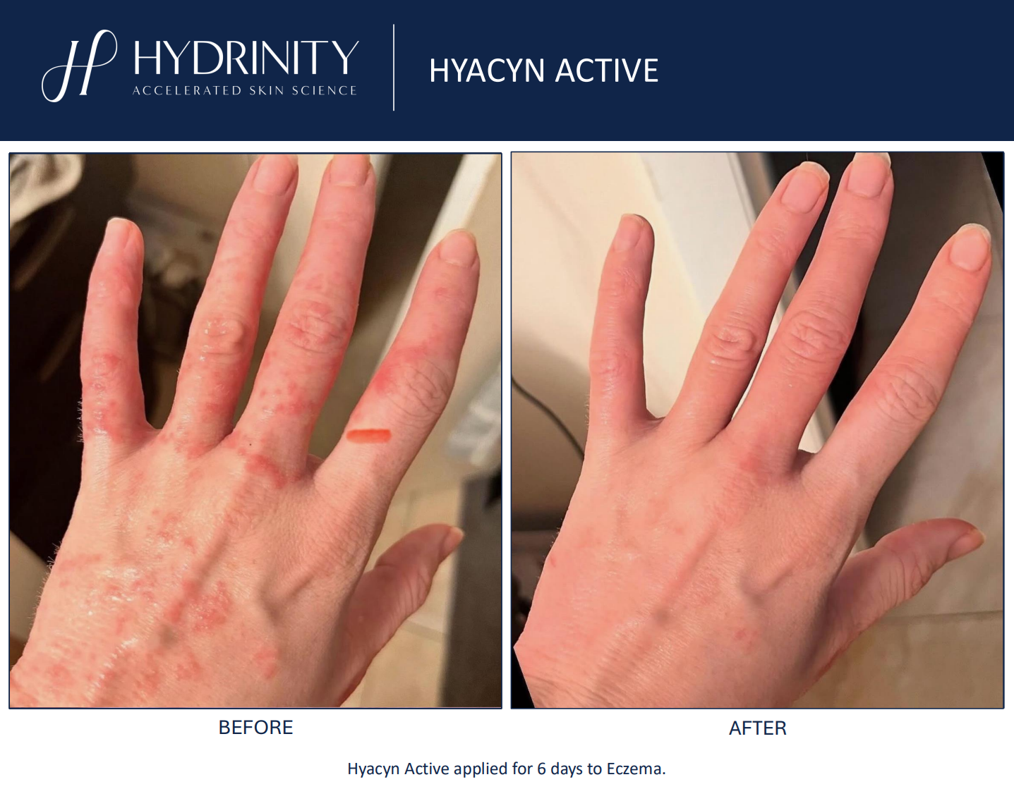 Hydrinity: Hyacyn Active | 90ml