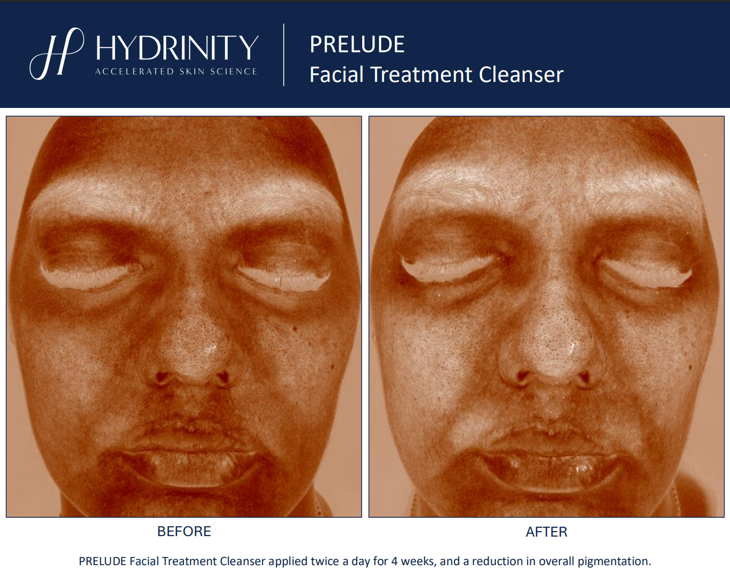 Hydrinity: Prelude Facial Treatment Cleanser | 180ml