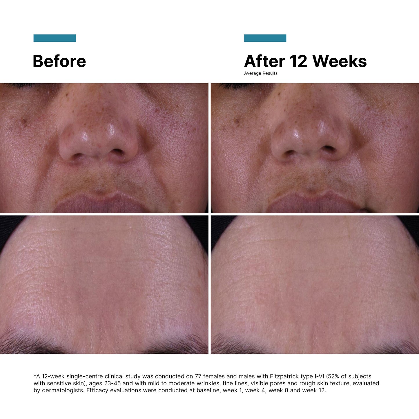 SkinCeuticals P-TIOX Anti-Wrinkle Cream 48ml