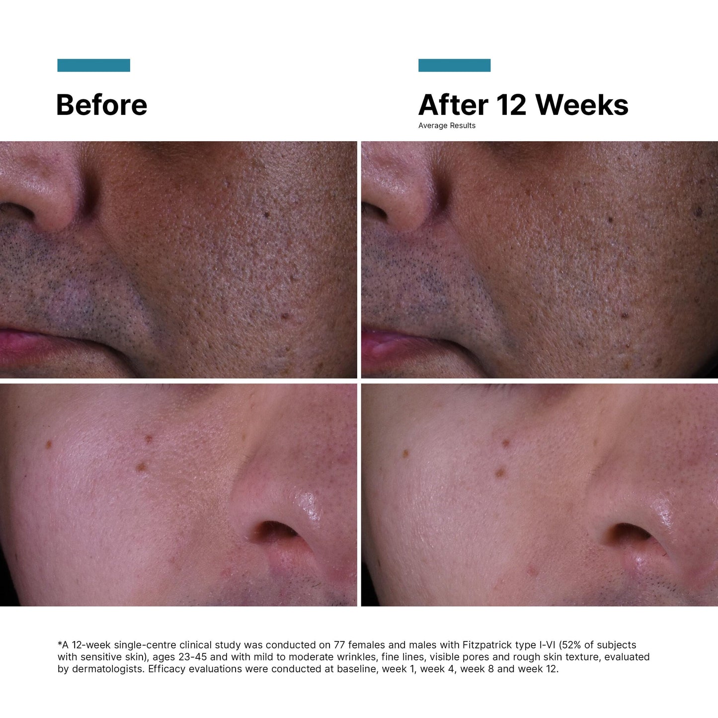SkinCeuticals P-TIOX Anti-Wrinkle Cream 48ml