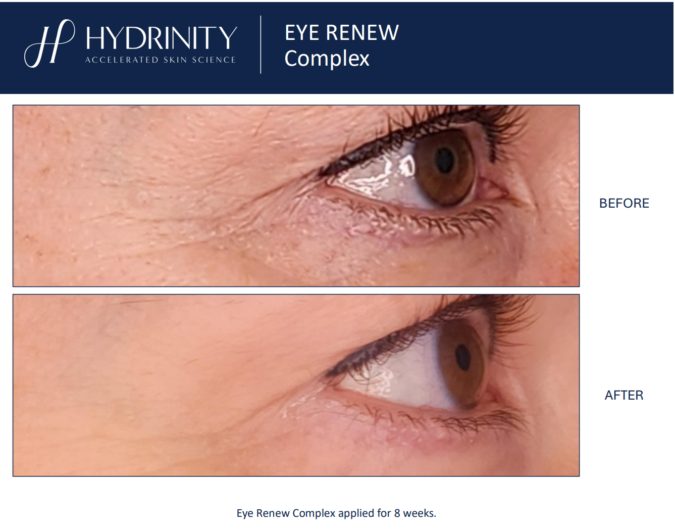 Hydrinity: Eye Renew Complex | 15ml