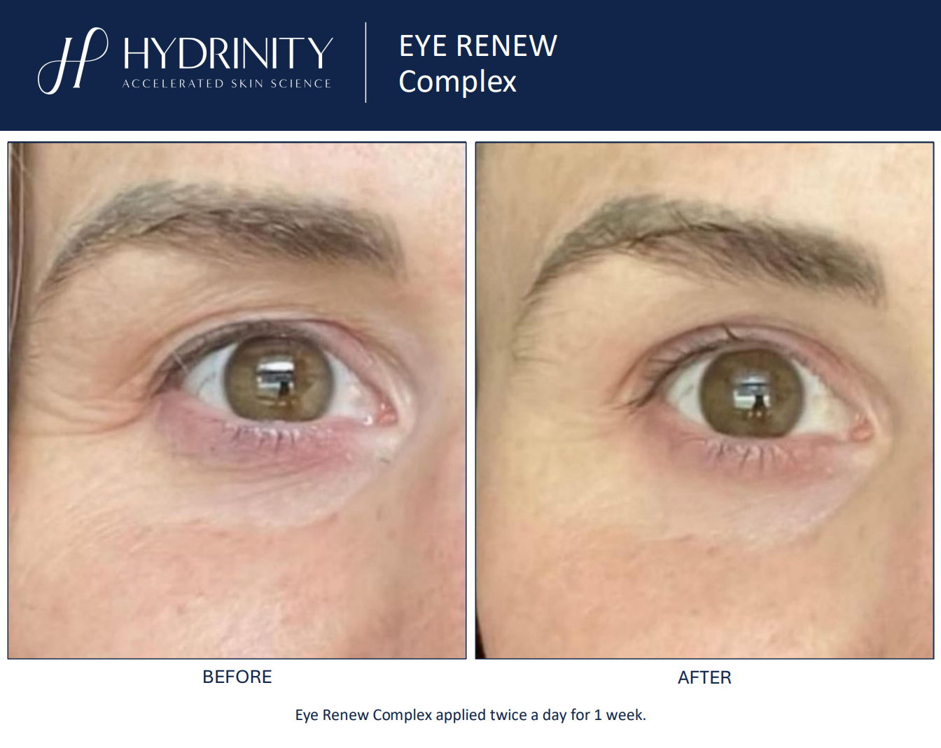 Hydrinity: Eye Renew Complex | 15ml