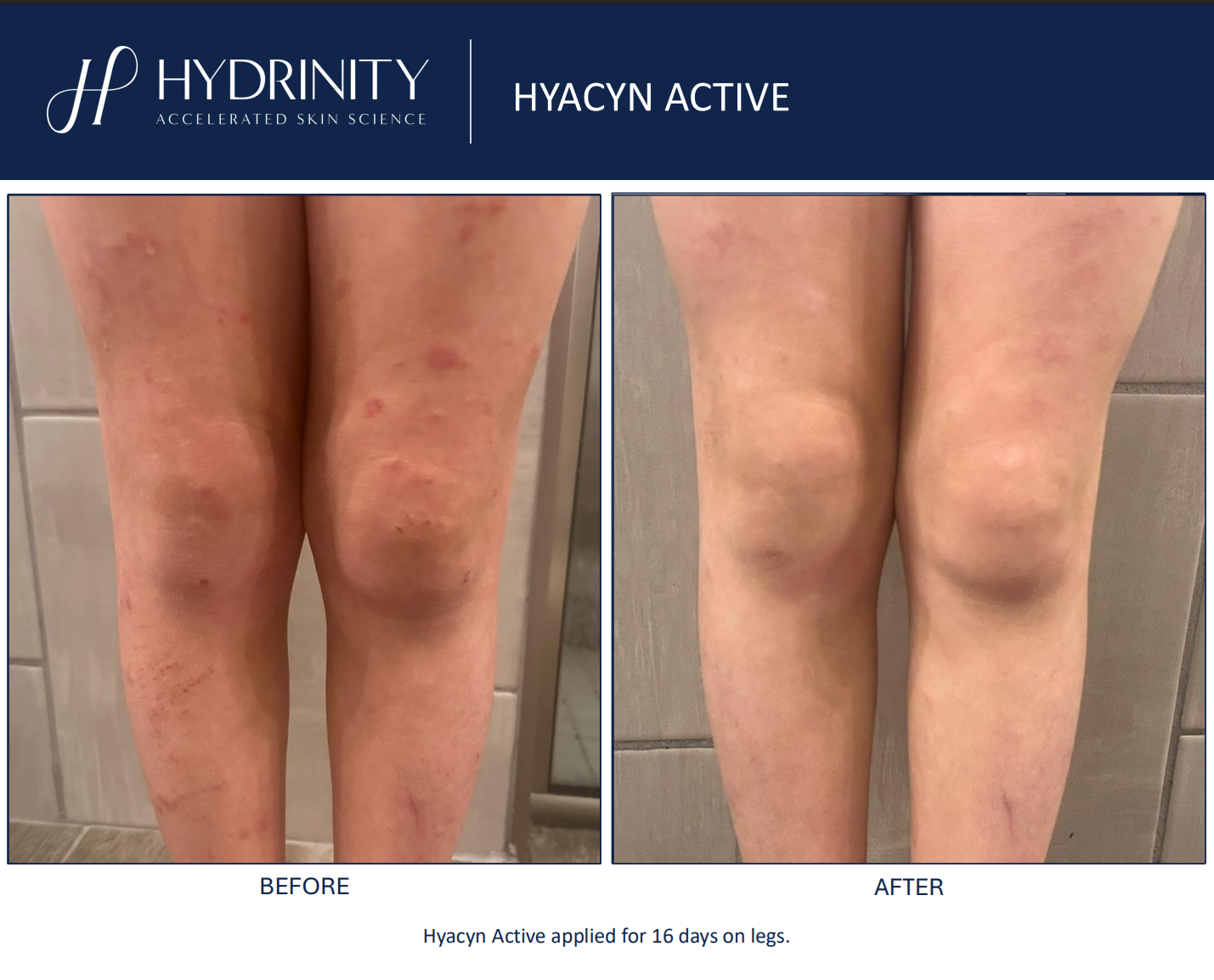 Hydrinity: Hyacyn Active | 90ml
