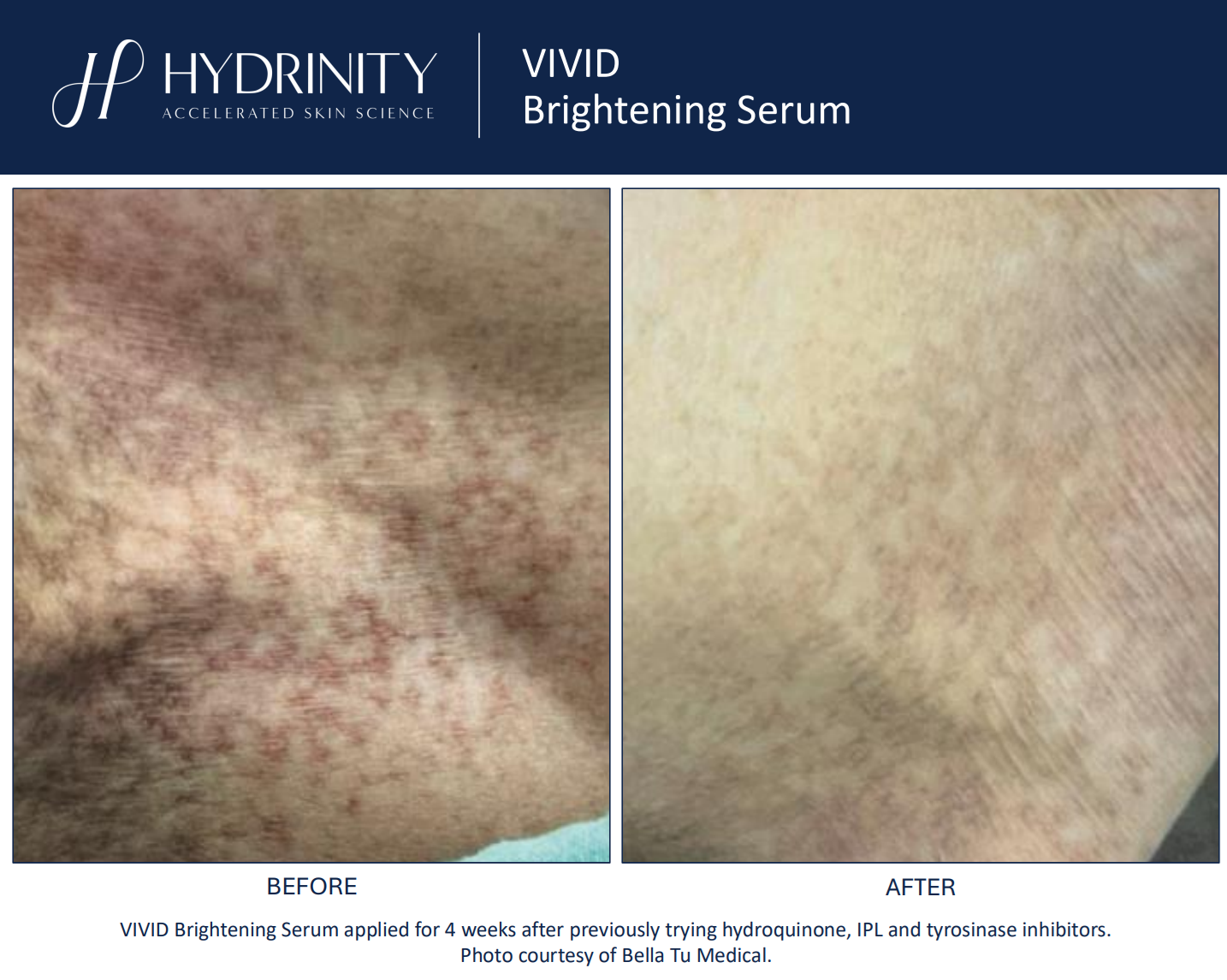 Hydrinity: Vivid Brightening Seurm | 30ml